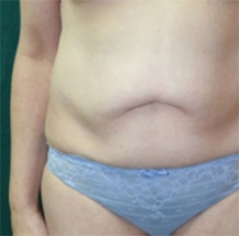 results before image